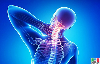 Device for treating cervical osteochondrosis designed in Dagestan
